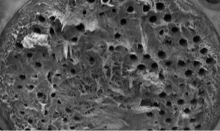 HXCI-skittent-filter-1