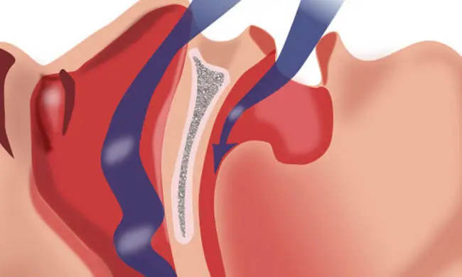 SpiroMedical_03